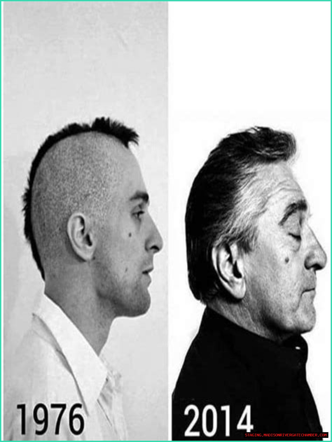 Understanding The De Niro Ear: A Comprehensive Guide